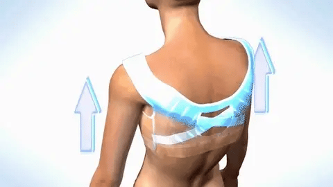 Allegra houding corrigerende BH – extra ondersteuning & comfort voor dagelijks gebruik